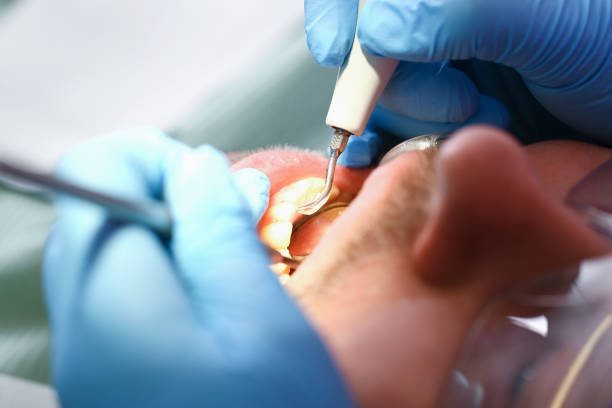 Best Emergency Dental Care for Trauma or Injury in Hazen, ND