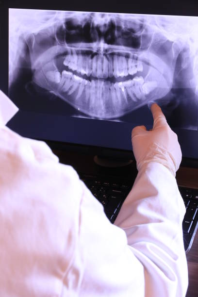 Best Walk-In Emergency Dentist in Hazen, ND