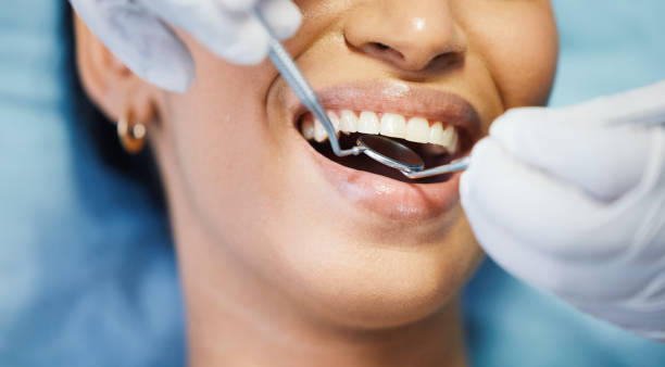 Best Emergency Broken Tooth Repair in Hazen, ND